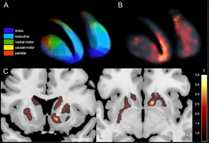 Research – Multimodal Neuroimaging Cologne
